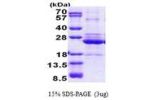 HLA-DOA, 26-217aa, Human