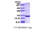 TRAPPC2L, 1-139aa, Human