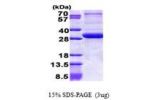 PEX26, 1-246aa, Human