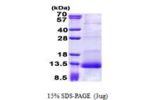 SPINK1, 24-79aa, Human