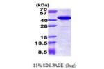 STBD1, 24-358aa, Human