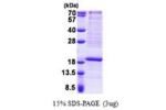 RPL22, 1-128aa, Human