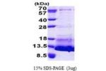 NPPC, 24-126aa, Human