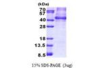 NANOGP8, 1-305aa, Human