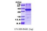 CA11, 24-328aa, Human