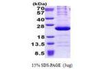 RPL11, 1-178aa, Human