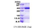 HLA-C, 25-308aa, Human