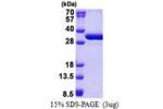 NSMCE1, 1-266aa, Human