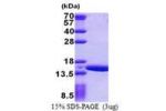 GTLF3B, 1-113aa, Human