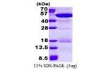 NCK2, 1-380aa, Human