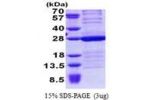 HMGB3, 1-180aa, Human