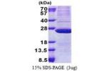 ATP5H, 1-161aa, Human