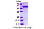 KLF3, 1-345aa, Human