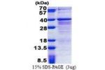 ZMAT3, 1-289aa, Human