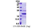 TMED10, 32-185aa, Human