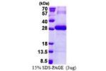PRSS3, 81-304aa, Human