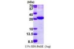 ATP1B2, 68-290aa, Human