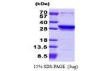CCDC25, 1-208aa, Human