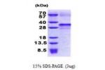 IGFBP6, 28-240aa, Human
