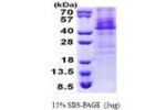 HOXC11, 1-304aa, Human