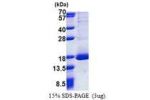 RPL30, 1-115aa, Human