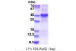 LIPG, 21-340aa, Human