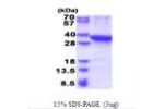 PROSC, 1-275aa, Human