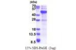 DNMT3L, 1-387aa, Human
