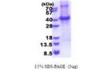 CD5, 25-372aa, Human