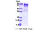 KRT5, 1-590aa, Human