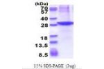 CLMP, 19-235aa, Human