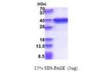 RPRD1A, 1-312aa, Human