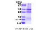 MED27, 1-311aa, Human
