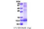CASP3, 176-277aa, Human