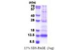 PF4V1, 31-104aa, Human
