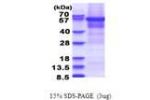 CPEB1, 1-561aa, Human