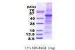 PLA1A, 26-456aa, Human