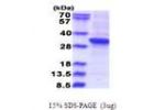 RSU1, 1-277aa, Human