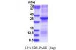 F2, 328-622aa, Human