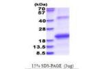 HCV-NS5b, 2634-2752aa, Hepatitis C Virus