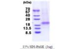 XAF1, 1- 125aa, Human