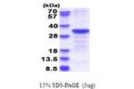 CYB5R2, 1-276aa, Human