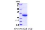 CAPNS1, 84-268aa, Human