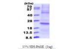 DUSP22, 1-184aa, Human