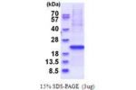 YIF1B, 1- 156aa, Human