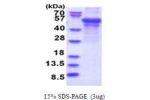 PLIN2, 1-437aa, Human, T7 tag