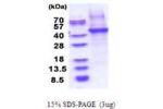 CD14, 20- 349aa, Human