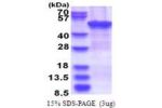 ZCCHC12, 1-402aa, Human