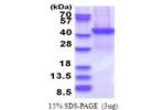PSMD13, 1-376aa, Human