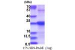 SDF2, 19-211aa, Human